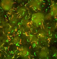 Borrelia burgdorferi